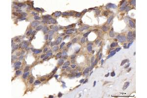 IHC analysis of DLST using anti-DLST antibody (ABIN7599412). (DLST antibody  (AA 1-453))