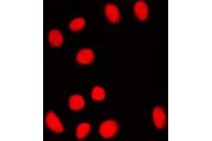 Immunofluorescent analysis of BRF1 staining in NIH3T3 cells. (BRF1 antibody  (Center))