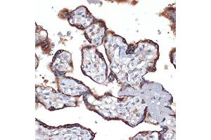 Immunohistochemistry of paraffin-embedded human placenta using TMEFF2 Rabbit mAb (ABIN1682727, ABIN3018560, ABIN3018561 and ABIN7101627) at dilution of 1:100 (40x lens). (TMEFF2 antibody)