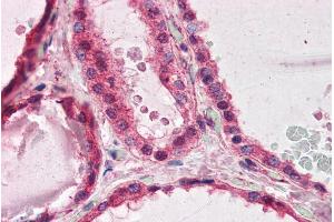 Immunohistochemistry (IHC) image for anti-Platelet-Activating Factor Acetylhydrolase 1b, Regulatory Subunit 1 (45kDa) (PAFAH1B1) (C-Term) antibody (ABIN184751)