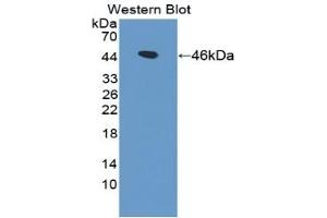 WB of Protein Standard: different control antibodies against Highly purified E. (Gelsolin ELISA Kit)