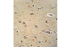 Formalin fixed and paraffin embedded human brain tissue reacted with PQLC1 Antibody  followed by peroxidase conjugation of the secondary antibody and DAB staining. (PQLC1 antibody  (Middle Region))