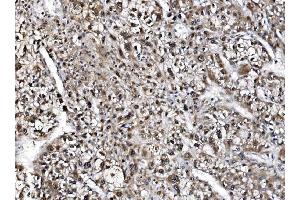 IHC analysis of NOLA1/GAR1 using anti-NOLA1/GAR1 antibody (ABIN7602076). (GAR1 antibody  (AA 58-165))