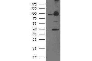 Western Blotting (WB) image for anti-Proteasome (Prosome, Macropain) 26S Subunit, Non-ATPase, 2 (PSMD2) antibody (ABIN1500482)
