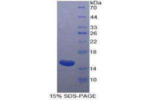 SDS-PAGE (SDS) image for Inhibin, beta A (INHBA) (AA 312-426) protein (His tag) (ABIN1877927) (INHBA Protein (AA 312-426) (His tag))