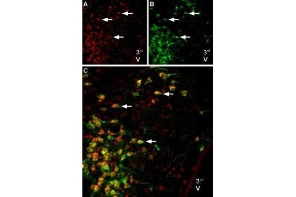 Melatonin Receptor 1B antibody  (3rd Intracellular Loop)
