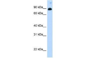 WB Suggested Anti-STAT6 Antibody Titration:  0. (STAT6 antibody  (C-Term))