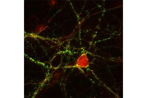 Immunocytochemistry (ICC) image for anti-Cell Adhesion Molecule 4 (CADM4) (AA 376-388) antibody (ABIN1742494) (Cell Adhesion Molecule 4 antibody  (AA 376-388))