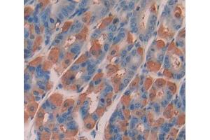 Used in DAB staining on fromalin fixed paraffin- embedded stomach tissue (DPP3 antibody  (AA 2-263))