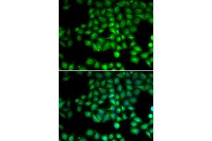 Immunofluorescence analysis of HeLa cells using TRPM2 antibody (ABIN5973615). (TRPM2 antibody)