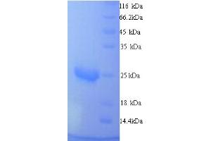 SDS-PAGE (SDS) image for Mucin 2, Oligomeric Mucus/gel-Forming (MUC2) (AA 36-240) protein (His tag) (ABIN4975617) (MUC2 Protein (AA 36-240) (His tag))