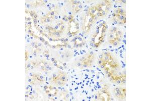 Immunohistochemistry of paraffin-embedded rat kidney using ATP7A antibody (ABIN5974582) at dilution of 1/100 (40x lens). (ATP7A antibody)