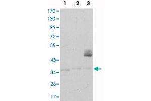 Western blot analysis using CD1A monoclonal antibody, clone 7A7  against K-562 (1), Raji (2), and MOLT 4 (3) cell lysate. (CD1a antibody)