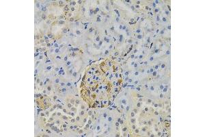 Immunohistochemistry of paraffin-embedded rat kidney using FLT3 antibody (ABIN6131275, ABIN6140693, ABIN6140696 and ABIN6223885) (40x lens). (FLT3 antibody)