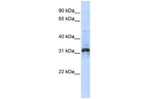 WB Suggested Anti-ZNF705D Antibody Titration:  0. (ZNF705D antibody  (Middle Region))