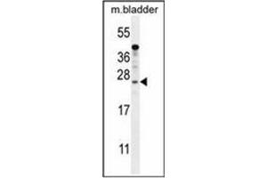 Western blot analysis of KIAA1644 antibody (N-term) in mouse bladder tissue lysates (35ug/lane). (SHISAL1/KIAA1644 antibody  (N-Term))
