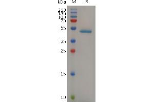Mouse PGL Protein, hFc Tag on SDS-PAGE under reducing condition.