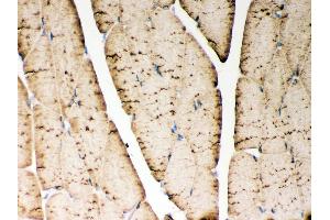 Anti- ATP2A1 antibody,IHC(P) IHC(P): Rat Skeletal Muscle Tissue