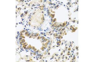 Immunohistochemistry of paraffin-embedded mouse lung using C8orf4 antibody at dilution of 1:100 (40x lens).