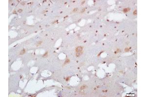 Formalin-fixed and paraffin embedded rat brain labeled with Anti-EXOC2/SEC5 Polyclonal Antibody, Unconjugated  at 1:200 followed by conjugation to the secondary antibody and DAB staining