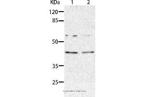 Western blot analysis of HepG2 and A549 cell, using AIMP2 Polyclonal Antibody at dilution of 1:350 (AIMP2 antibody)