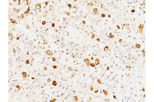 Formalin-fixed, paraffin-embedded human Pituitary stained with FSH beta Mouse Monoclonal Antibody (FSHb/1062). (FSHB antibody)