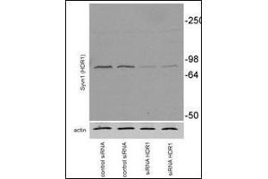 Western Blotting (WB) image for anti-Synovial Apoptosis Inhibitor 1, Synoviolin (SYVN1) (AA 586-617), (C-Term) antibody (ABIN388980)