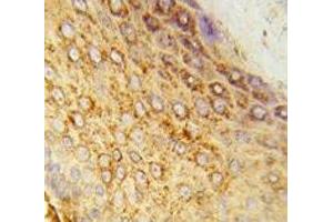 IHC analysis of FFPE human skin tissue stained with LDHA antibody (Lactate Dehydrogenase A antibody  (AA 154-182))