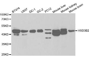 Western blot analysis of extracts of various cell lines, using HSD3B2 antibody. (HSD3B2 antibody)