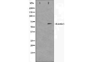 Western blot analysis on HepG2 cell lysate using Keratin 5 Antibody. (Cytokeratin 5 antibody  (C-Term))