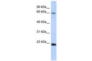 Image no. 1 for anti-DNA repair and recombination protein RAD54B (RAD54B) (C-Term) antibody (ABIN6740311) (RAD54B antibody  (C-Term))
