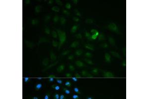 Immunofluorescence analysis of MCF-7 cells using CD79B Polyclonal Antibody (CD79b antibody)