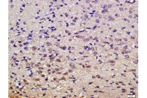 Formalin-fixed and paraffin embedded rat brain labeled with Rabbit Anti-MSK1 (Ser376) Polyclonal Antibody, Unconjugated  at 1:200 followed by conjugation to the secondary antibody and DAB staining (MSK1 antibody  (pSer376))