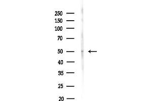 anti-Zinc Finger Protein 436 (ZNF436) (C-Term) antibody
