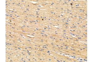 Phospho-Anillin (Ser635) Antibody at 1/100 staining Rat heart tissue by IHC-P.