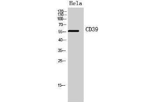 Western Blotting (WB) image for anti-Ectonucleoside Triphosphate diphosphohydrolase 1 (ENTPD1) (Internal Region) antibody (ABIN3178932) (CD39 antibody  (Internal Region))