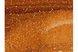 ABIN6255298 and ABIN6267360 at 1/100 staining Mouse brain tissue by IHC-P. (tau antibody  (pSer396))