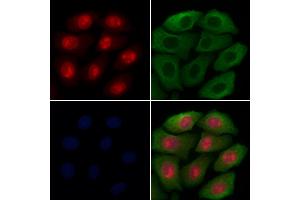 ABIN7094628 and ABIN7098678 staining Hela cells by IF/ICC. (LOXL2 antibody  (Internal Region))