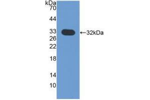 Western blot analysis of recombinant Mouse CHIT1. (Chitotriosidase 1 antibody  (AA 210-464))