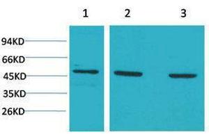 Western Blotting (WB) image for anti-Mitogen-Activated Protein Kinase Kinase 5 (MAP2K5) antibody (ABIN3181576) (MAP2K5 antibody)