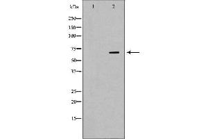 Western blot analysis of A431  lysate using RPA1 antibody. (RPA1 antibody  (Internal Region))
