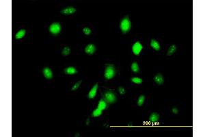 Immunofluorescence of monoclonal antibody to ID3 on HeLa cell. (ID3 antibody  (AA 1-83))