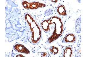 Immunohistochemistry (IHC) image for anti-Keratin 18 (KRT18) antibody (ABIN6939932)
