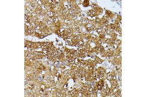 Immunohistochemistry of paraffin-embedded rat liver using Septin 4 antibody (ABIN6128476, ABIN6147554, ABIN6147555 and ABIN6214410) at dilution of 1:100 (40x lens). (Septin 4 antibody  (AA 1-100))