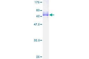 MEOX2 Protein (AA 1-303) (GST tag)