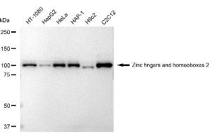 Western blotting analysis using Zinc fingers and homeoboxes 2 antibody (ABIN7800905).
