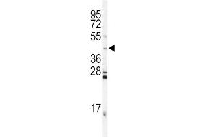 Western Blotting (WB) image for anti-Inhibin, alpha (INHA) antibody (ABIN3002774) (Inhibin alpha antibody)