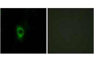 Immunofluorescence analysis of HeLa cells, using 5-HT-2B Antibody. (Serotonin Receptor 2B antibody  (AA 261-310))