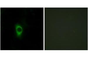 Immunofluorescence analysis of HeLa cells, using 5-HT-2B Antibody. (Serotonin Receptor 2B antibody  (AA 261-310))