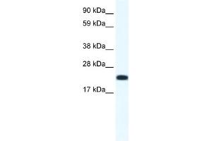 WB Suggested Anti-CITED4 Antibody Titration:  1. (CITED4 antibody  (N-Term))